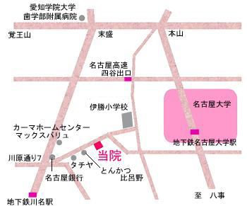 矯正歯科 歯列矯正 成人歯列矯正 インプラント 名古屋市 昭和区 前山歯科